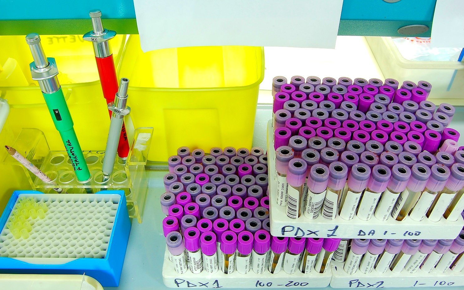 A laboratory bench with pipettes and research equipment