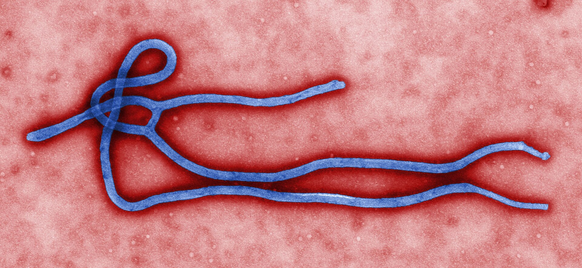 Colourised electron microscope image of Ebola virus particles