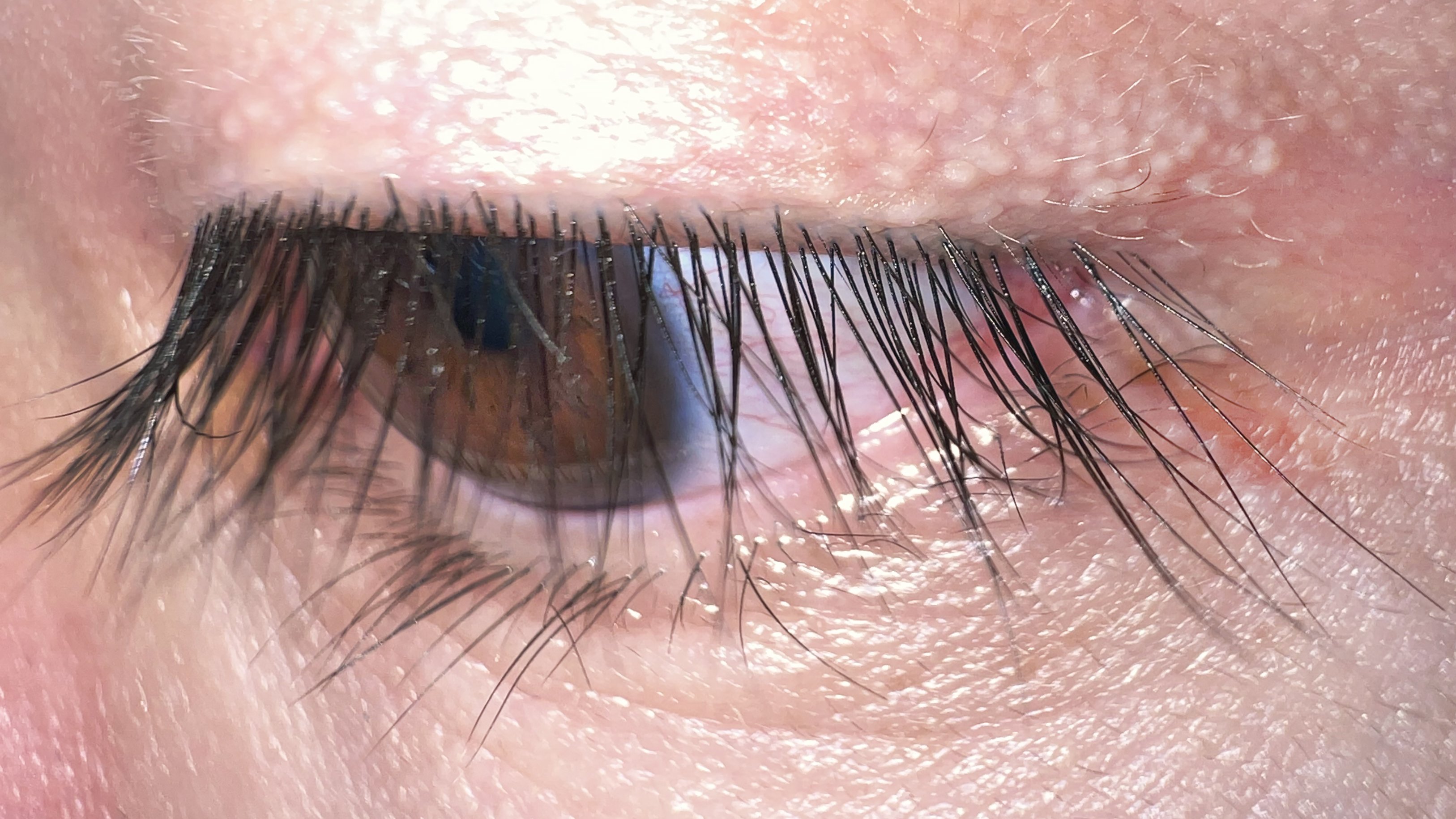Long upper and lower eyelashes on a man's eye, seen close up