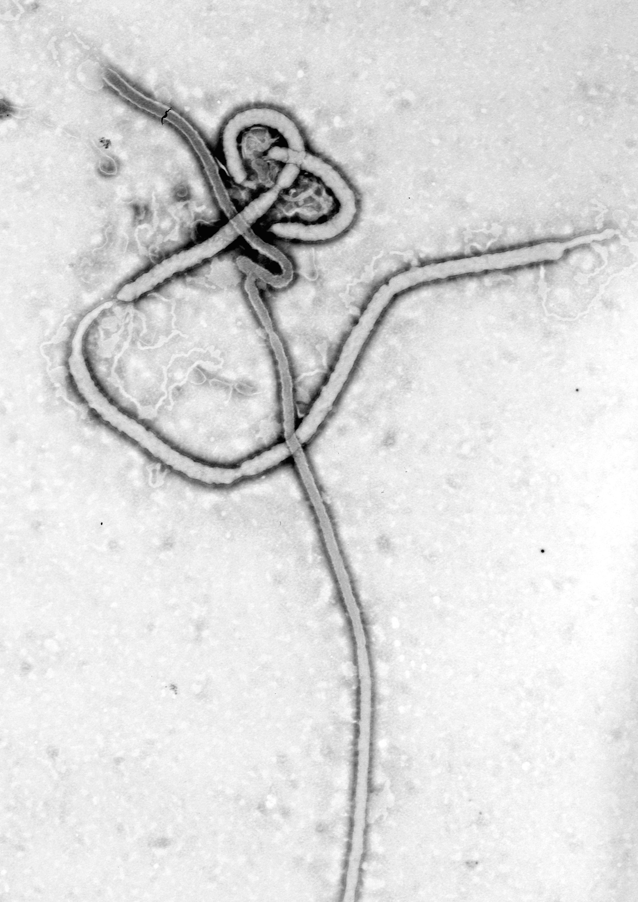 Electron micrograph of an Ebola virus particle