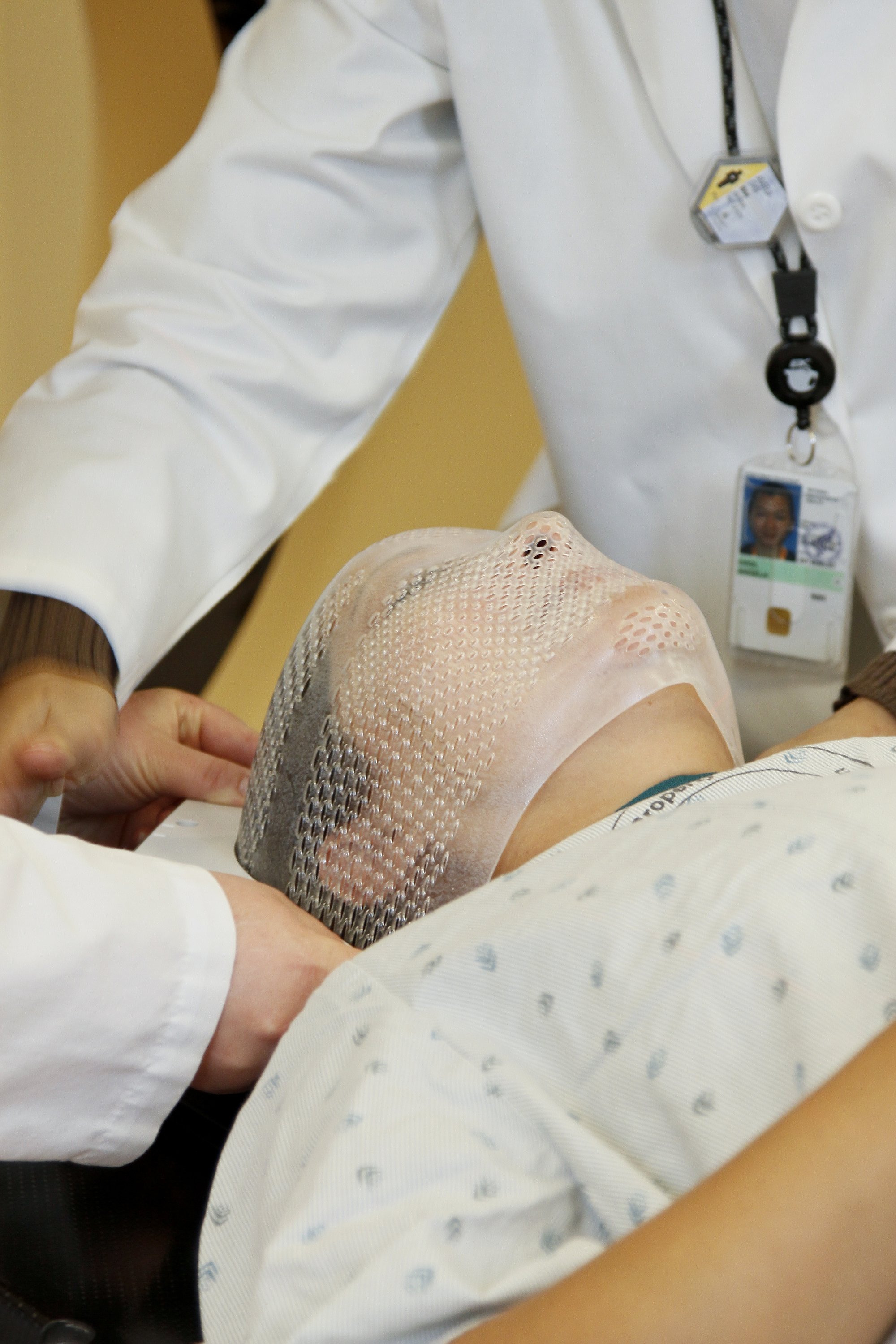 Radiation therapists fit a mask to steady a patient
