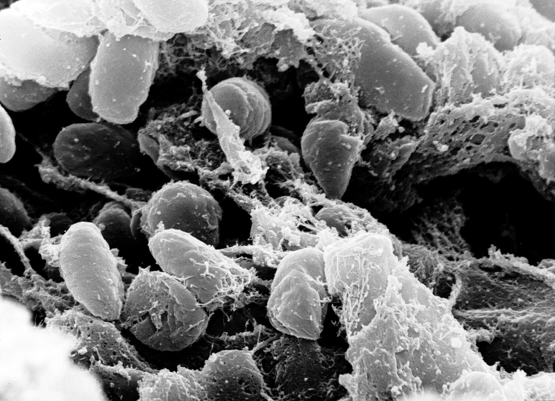 Scanning electron microscope image of a mass of Yersinia pestis, the plague bacterium