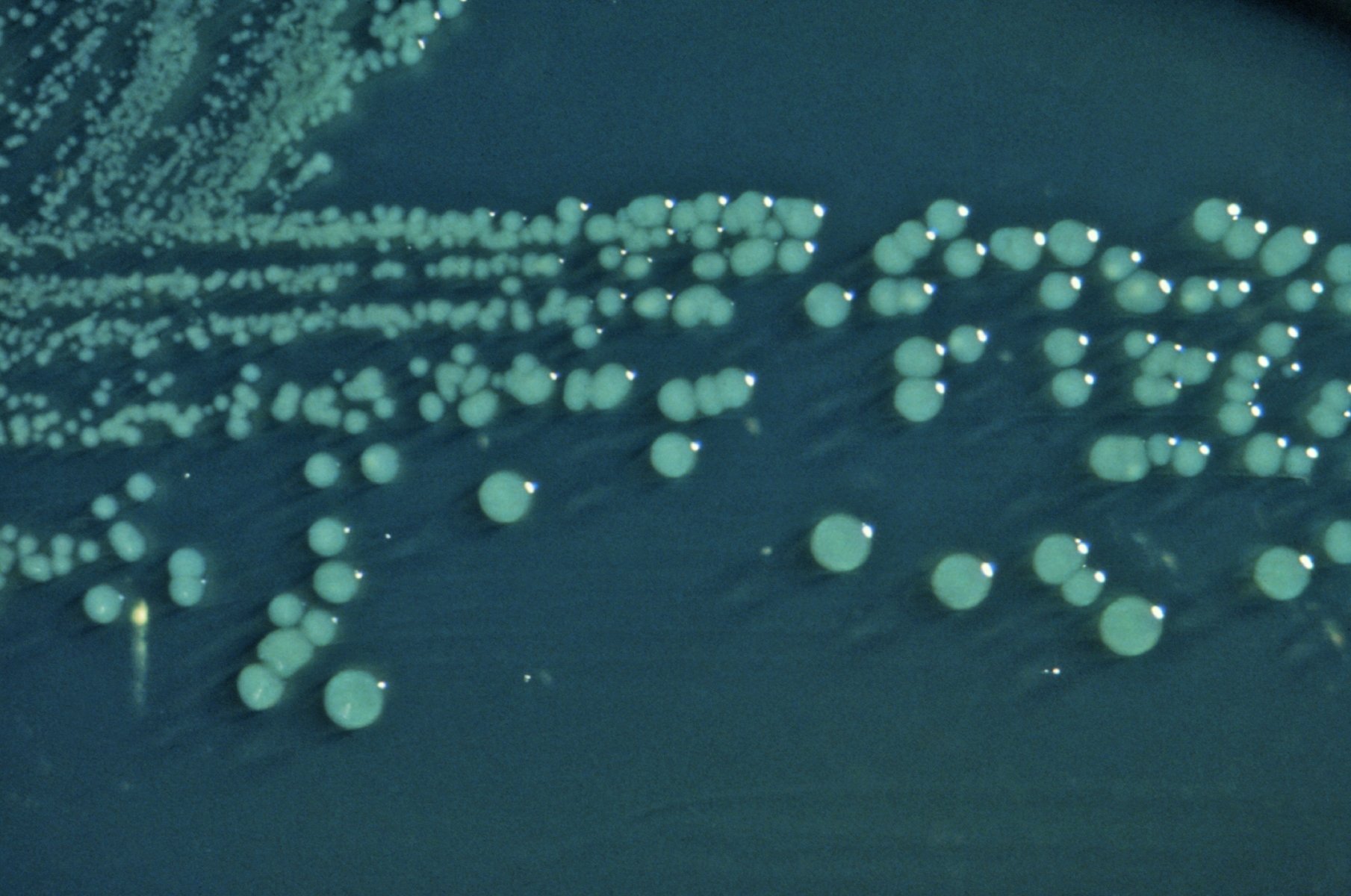 Pale round Shigella colonies growing in streaks across a dark lab culture plate
