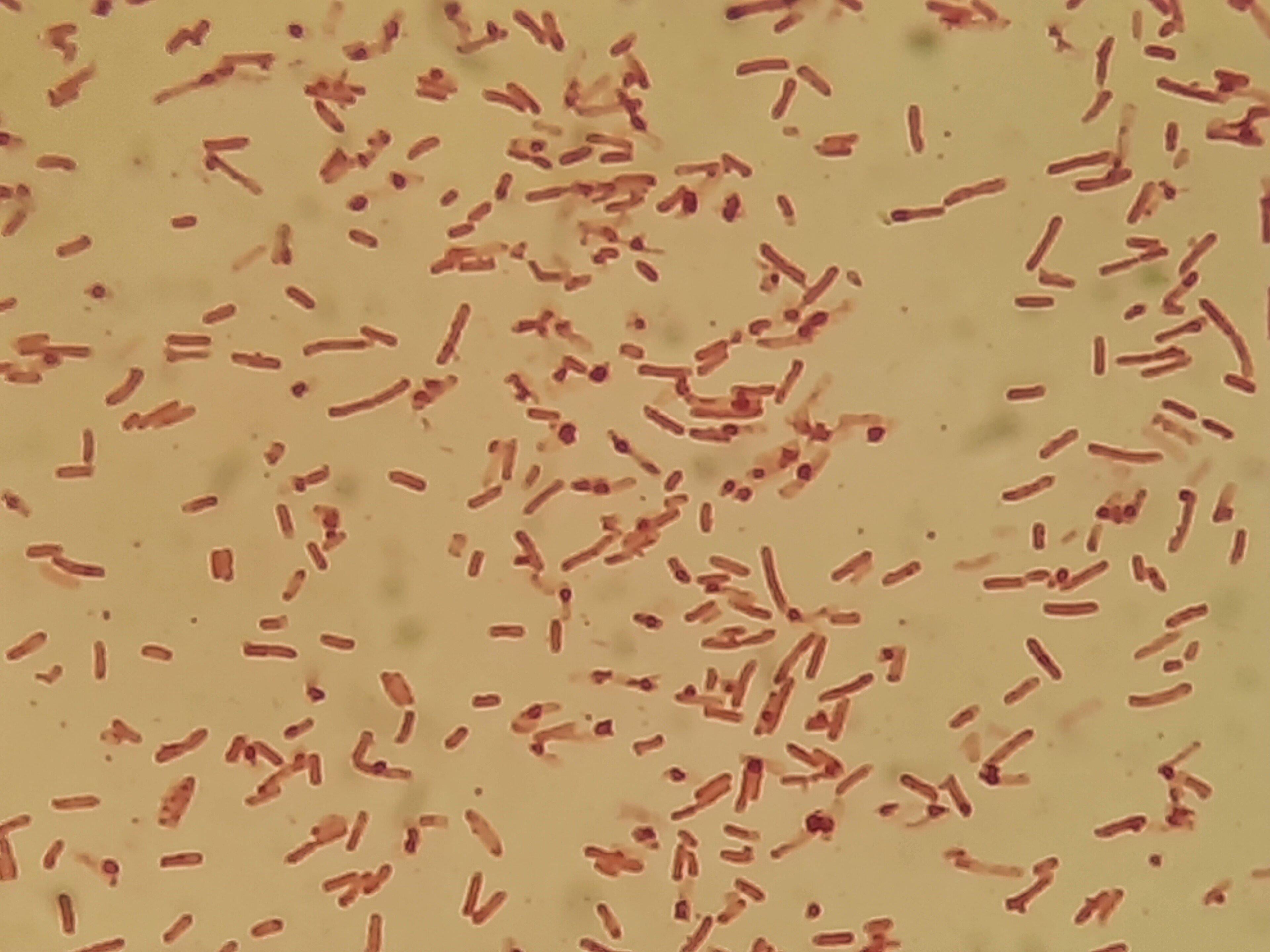 Shigella sonnei bacteria seen as small pink rods in a Gram stain under a microscope