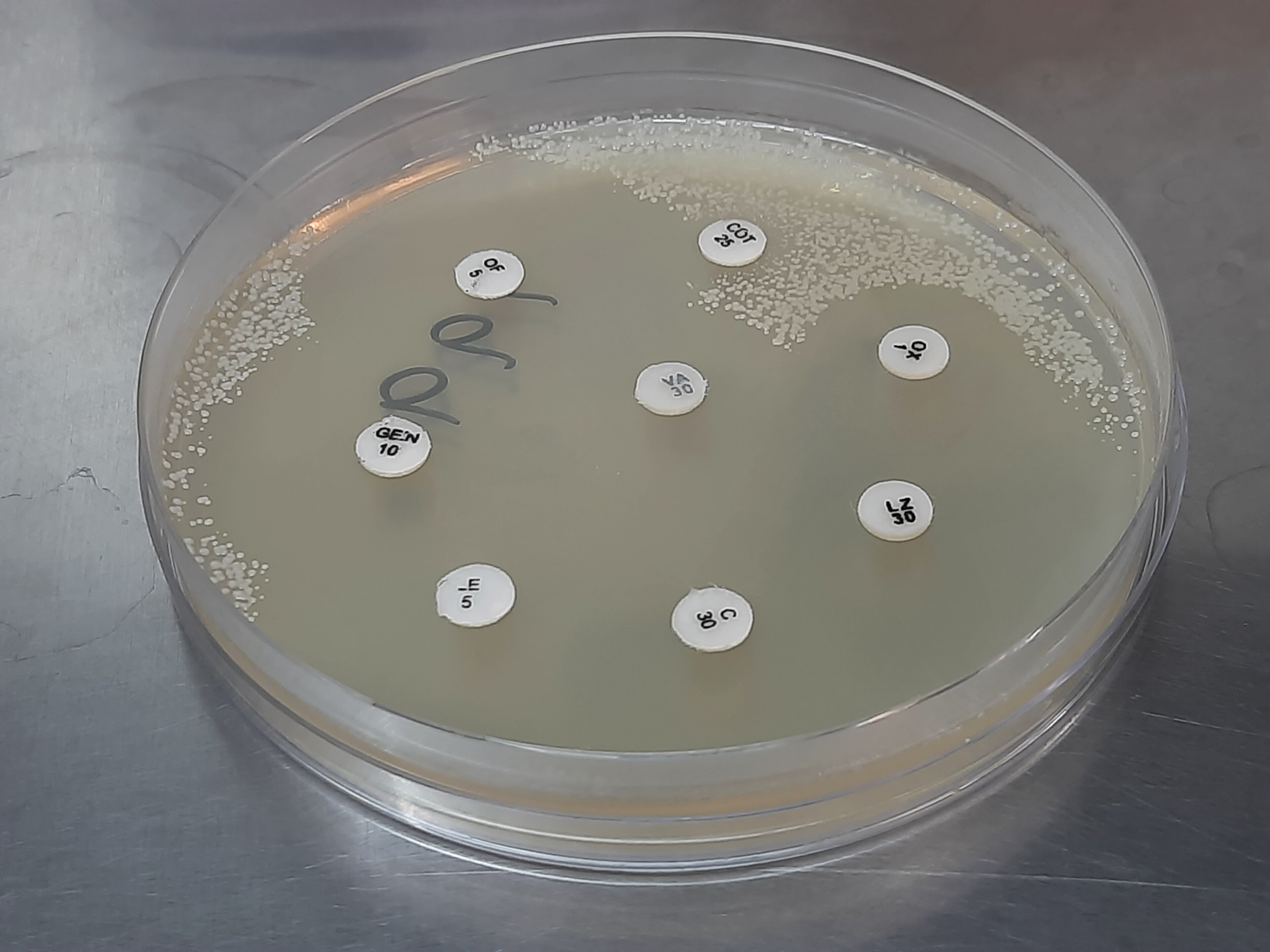 An antibiotic test plate with small paper discs on yellow agar, with clear rings around some discs