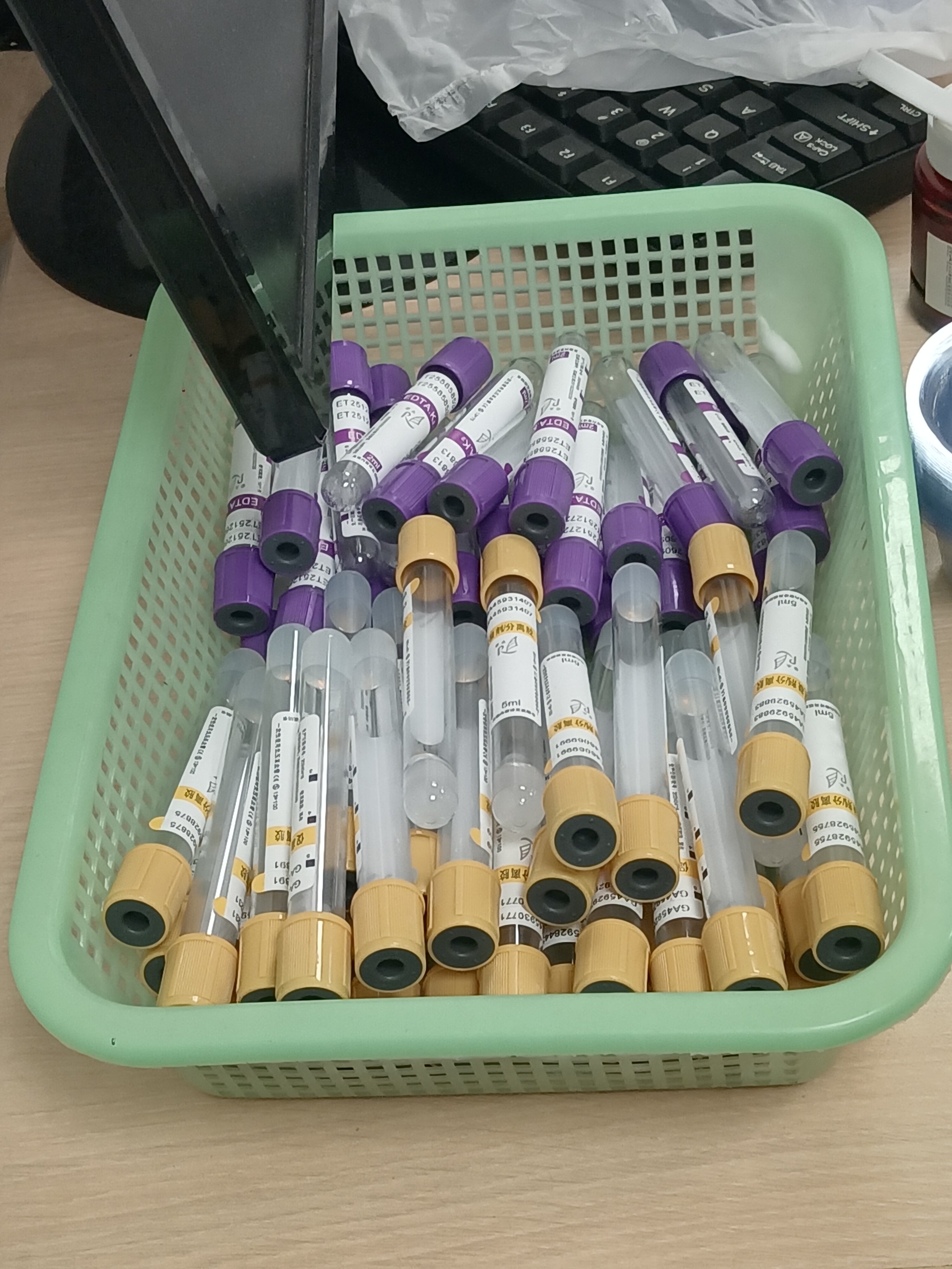 A blood collection tube on a white surface